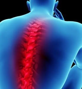 Workplace Spinal Cord Injury